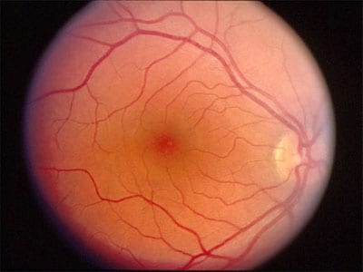 retina